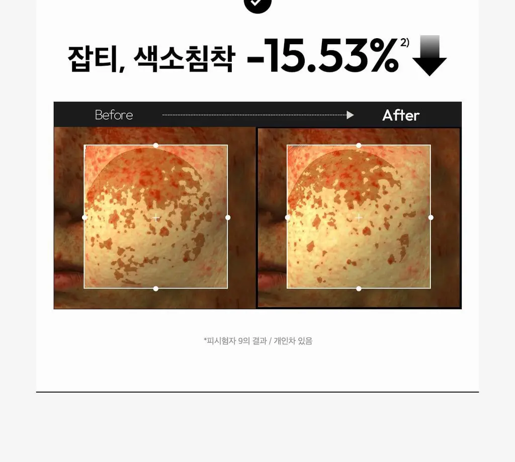 [기미잡티세럼] 레이어랩 기미흔적 클리어 세럼 30ml 상세페이지 21